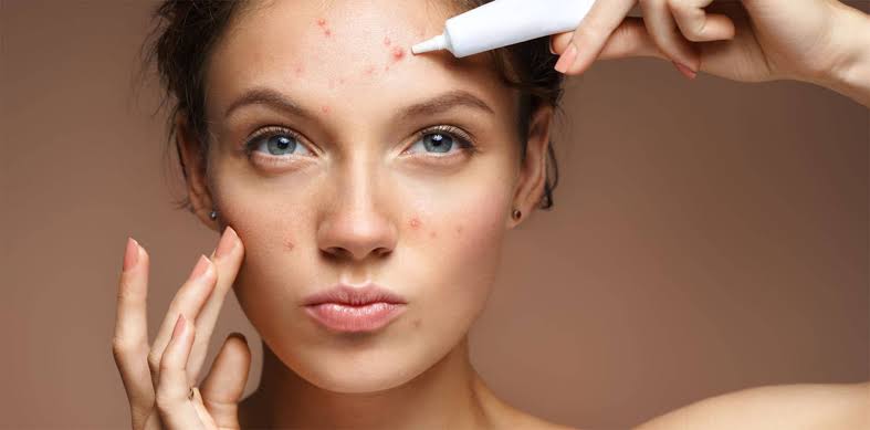 Luxury beauty portrait with clear skin texture for acne treatment